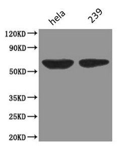 Podocalyxin antibody