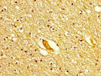 POLD1 Antibody