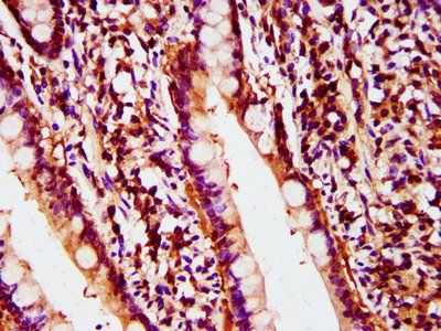 POLD2 Antibody