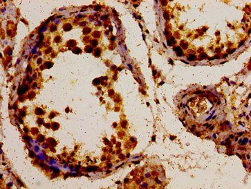 POLDIP3 Antibody