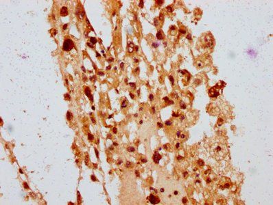 POLE4 Antibody