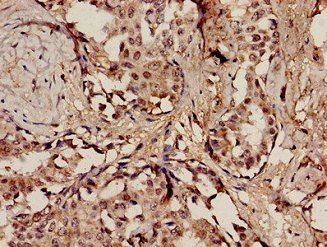 POLE Antibody