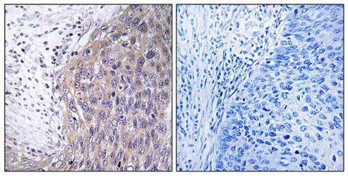 POLG2 antibody