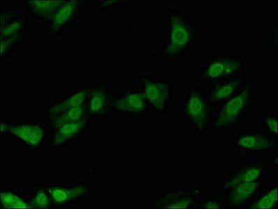 POLL Antibody