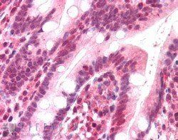 Goat anti-POLL / POLkappa Antibody