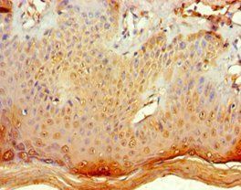 POLR1D Antibody