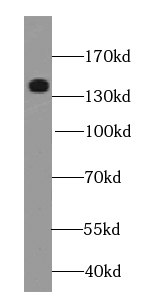 POLR2B-Specific antibody