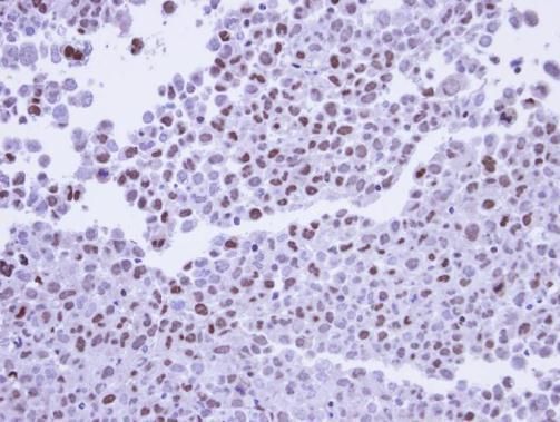 POLR2G Rabbit Polyclonal Antibody