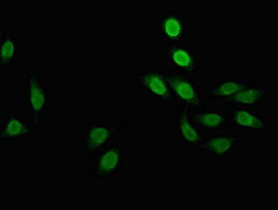 POLR2M Antibody