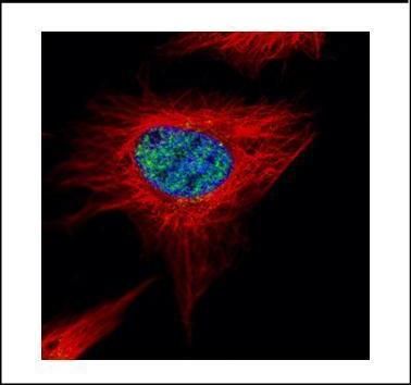 RNA polymerase III subunit A Antibody