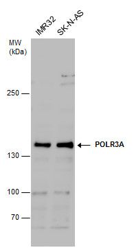 POLR3A Rabbit Polyclonal Antibody