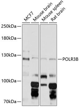 POLR3B antibody