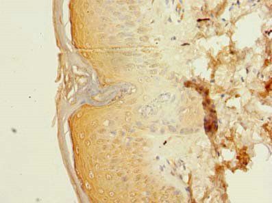 POLR3E antibody