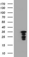 POLR3GL Antibody