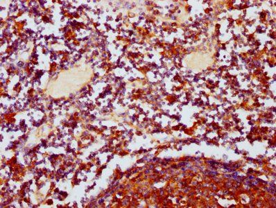 POLRMT Antibody