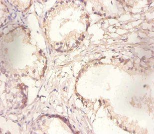 Poly(A)-specific ribonuclease PARN antibody