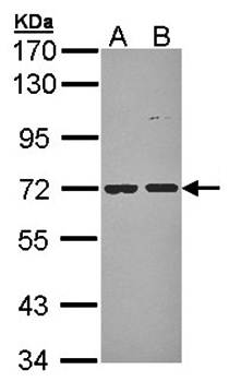 POMGNT1 antibody