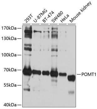 POMT1 antibody