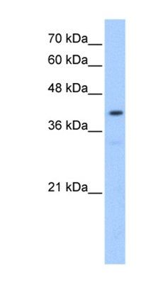 POMT2 antibody
