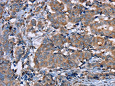 PON1 Antibody