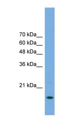 POP5 antibody