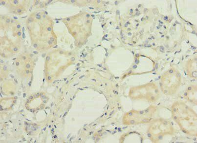 PORCN Antibody