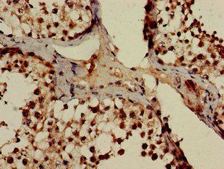POT1 Antibody