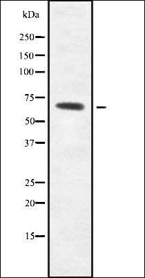 POTE14/22 antibody