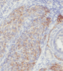 POTEA-Specific antibody