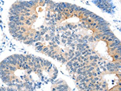 POU2F2 Antibody