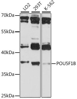 POU5F1B antibody