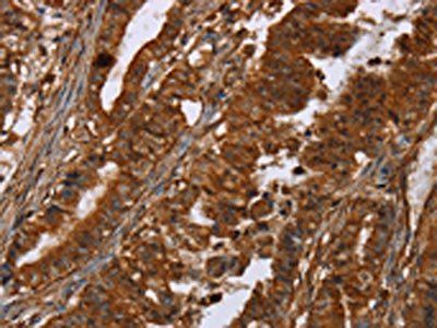 POU6F2 Antibody