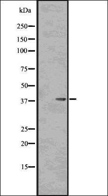 PP1 alpha (Phospho-Thr320) antibody