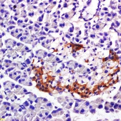 PP-1B Mouse Polyclonal Antibody