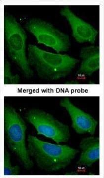 PP1C gamma antibody [N1C2]