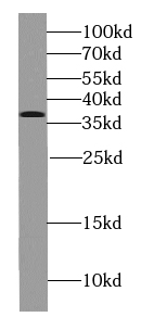 PP2A antibody