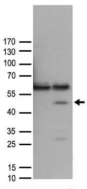 PP4R4 (PPP4R4) antibody