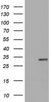 PP5 (PPP5C) antibody