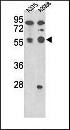 PP5 antibody