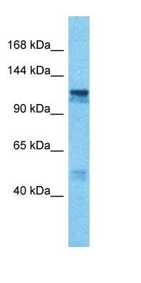 PP6R2 antibody