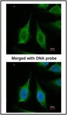PPA1 antibody