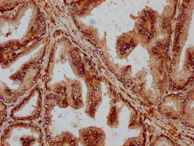 PPA2 Antibody