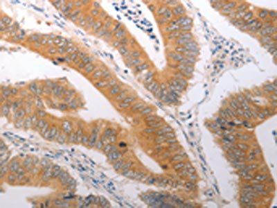 PPAP2C Antibody