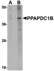 PPAPDC1B Antibody