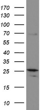 PPAR delta (PPARD) antibody