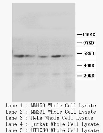 Anti-PPAR gamma/PPARG Antibody