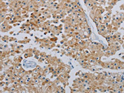 PPARGC1B Antibody
