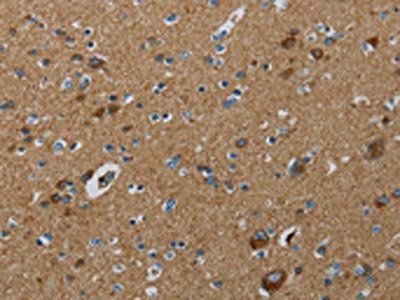 PPARGC1B Antibody