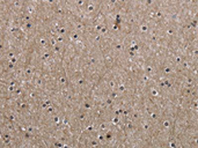 PPAT Antibody