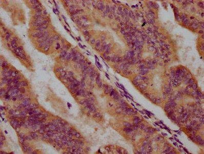 PPCDC Antibody